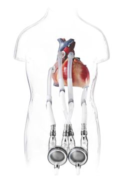 Japonsko má prvé dieťa s umelým srdcom