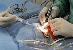 Počet výkonov jednodňovej chirurgie sa v poslednom čase výrazne nezmenil