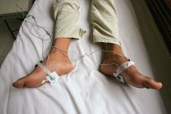 Závislosť mladých na internete liečili v Číne elektrošokmi