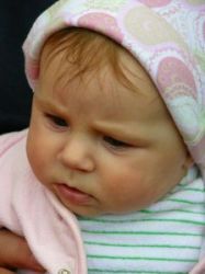 Najčastejšie kožné ochorenia detí