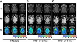 „Adresované“ lieky pre mozog