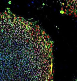 Kmeňové bunky obnovujú schopnosti mozgu