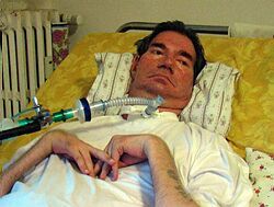 Zomrel ochrnutý Talian žiadajúci o odpojenie od respirátora