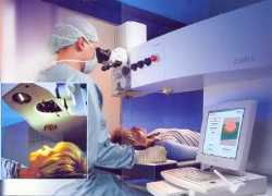 Zákroky očí eximerovým laserom