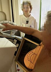 Nový mamograf v Šaci skrátil čakacie lehoty