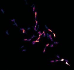 Rakovinové bunky si zachovávajú biorytmus