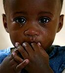 Utrpenie detí chorých na AIDS sa často prehliada