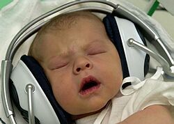 Ľudia, ktorí pravidelne počúvajú cez slúchadlá hlasnú hudbu, môžu ohluchnúť