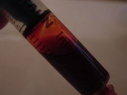 Aferéza - produktívna a liečebná