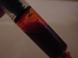 Aferéza - produktívna a liečebná