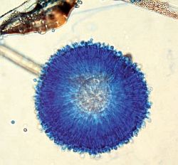 Ochratonín A - zdravotné riziká